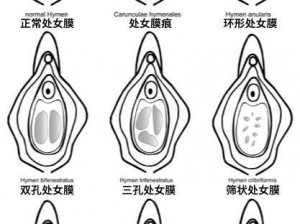 为什么处女开破视频处 CT 开如此重要？如何找到相关资源？怎样正确看待处女开破视频处 CT 开？