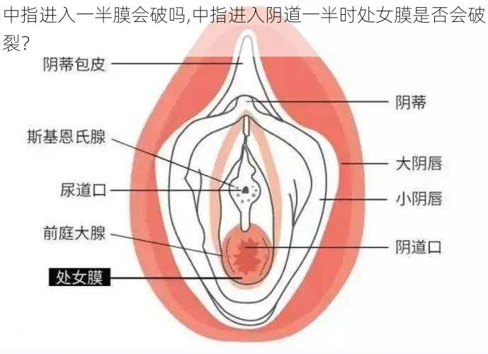 中指进入一半膜会破吗,中指进入阴道一半时处女膜是否会破裂？