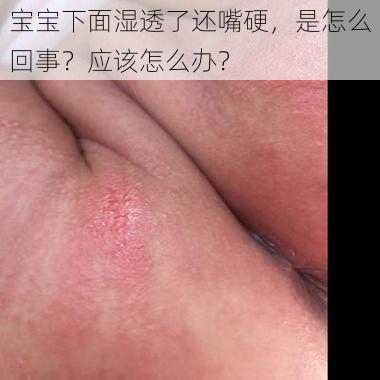 宝宝下面湿透了还嘴硬，是怎么回事？应该怎么办？