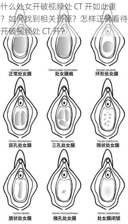 为什么处女开破视频处 CT 开如此重要？如何找到相关资源？怎样正确看待处女开破视频处 CT 开？