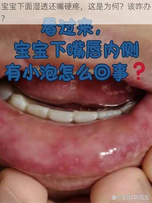 宝宝下面湿透还嘴硬疼，这是为何？该咋办？